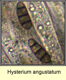 Hysterium angustatum