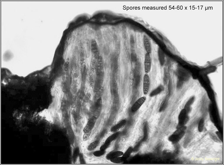 Navicella pileata, microscope photograph