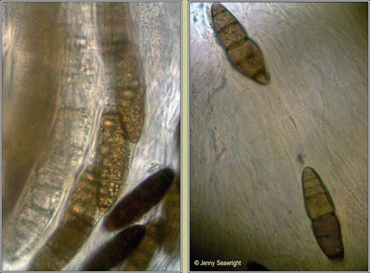 Navicella pileata, asci and ascospores