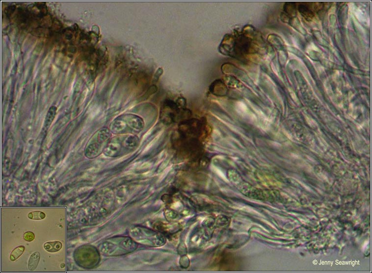 Xanthoria parietina, microscope image
