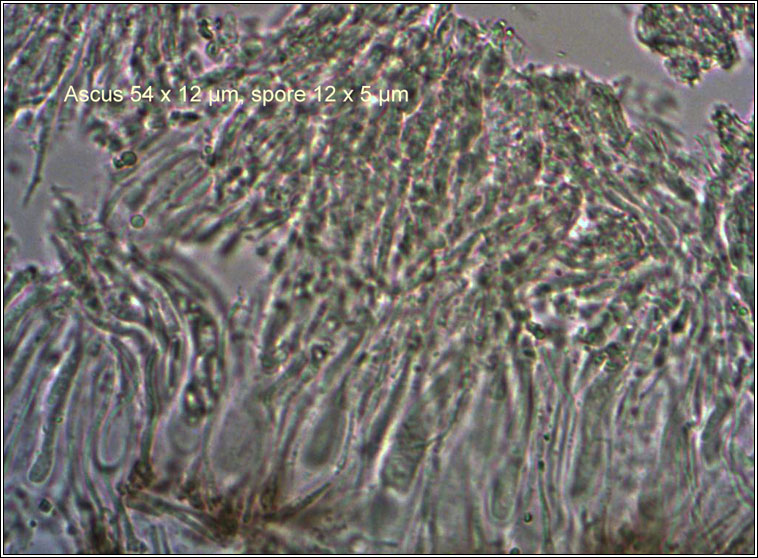 Lecidea lithophila, ascus and spores