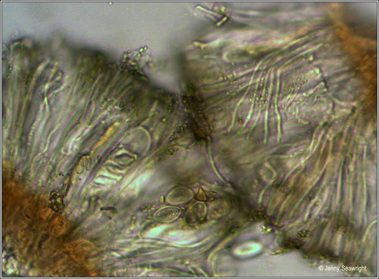 Lecidella elaeochroma, microscope image