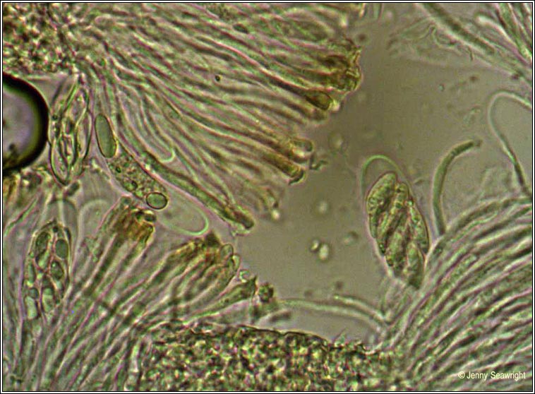 Degelia plumbea, microscope photo