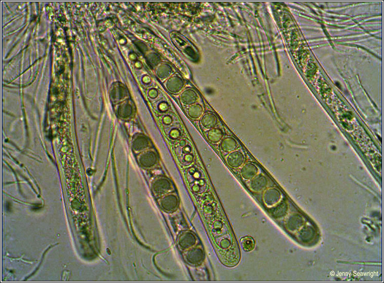 Megalaria grossa, asci