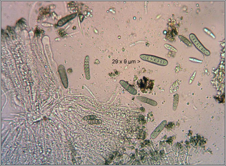 Phaeographis smithii, ascospores