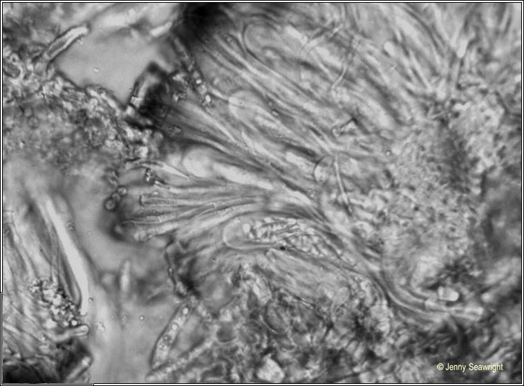 Collema multipartitum, ascus