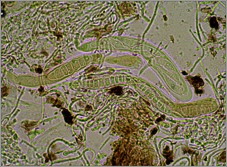 Graphis elegans, microscope photo