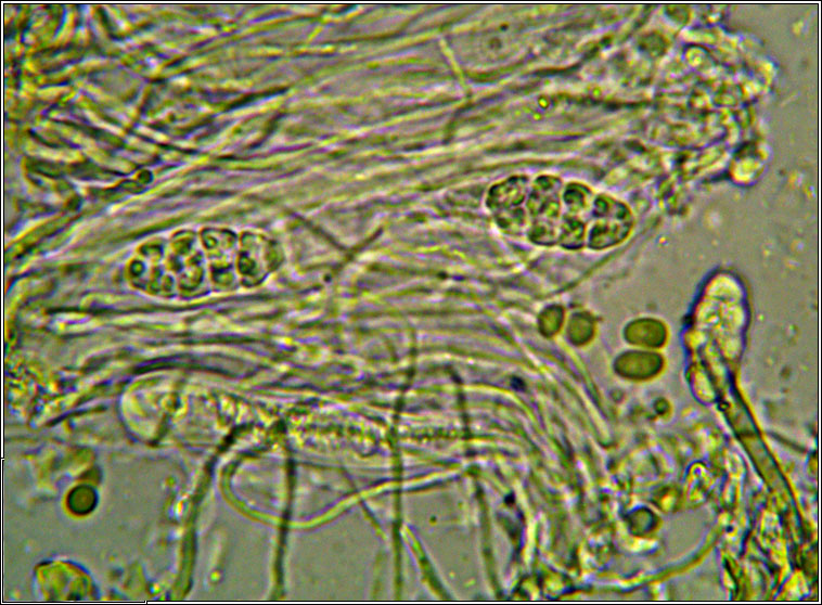 Leptogium pulvinatum, ascus and spores
