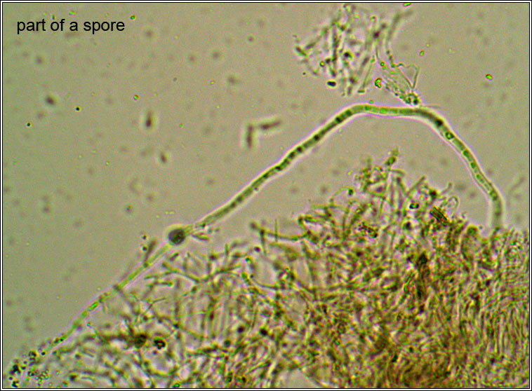 Gomphillus calycioides, paraphyses