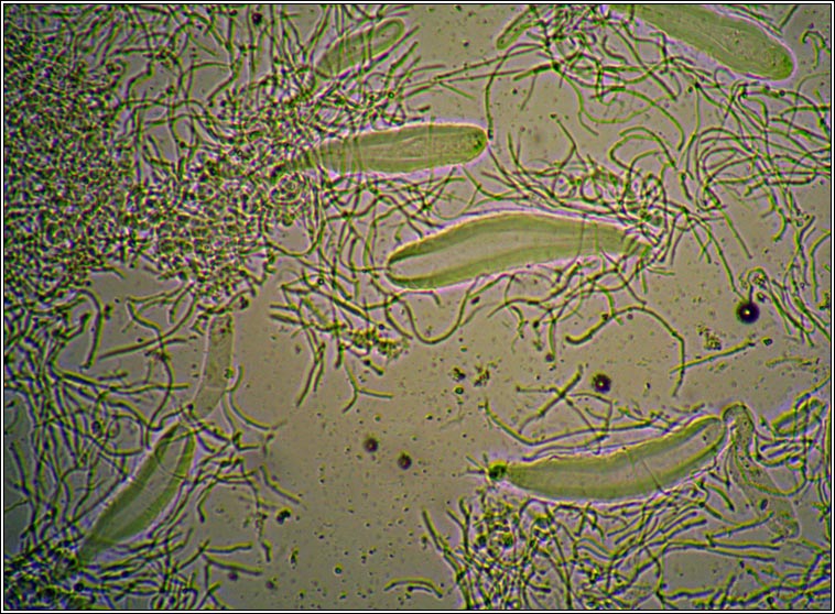 Pertusaria multipuncta, asci