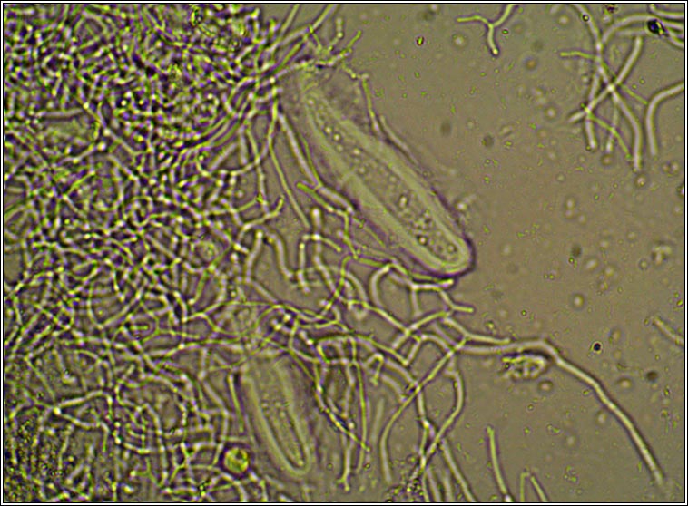 Pertusaria multipuncta, ascospores