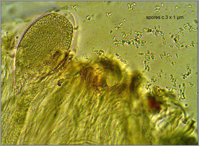Acarospora smaragdula, ascus and spores