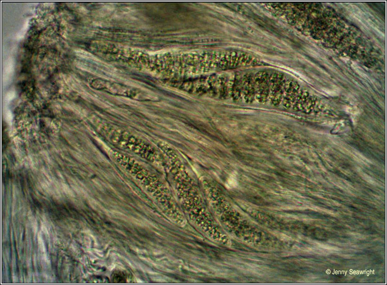 Thelotrema lepadinum