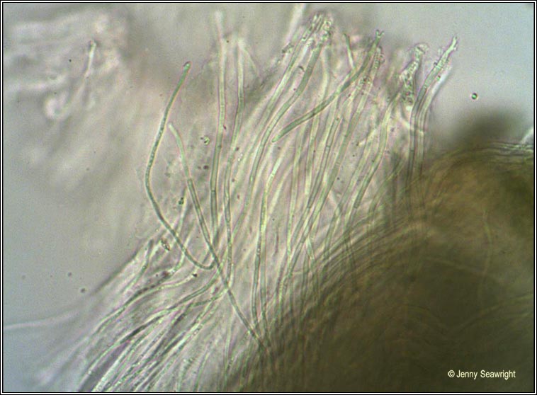 Thelotrema lepadinum, paraphyses
