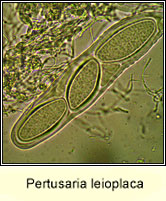 Pertusaria leioplaca