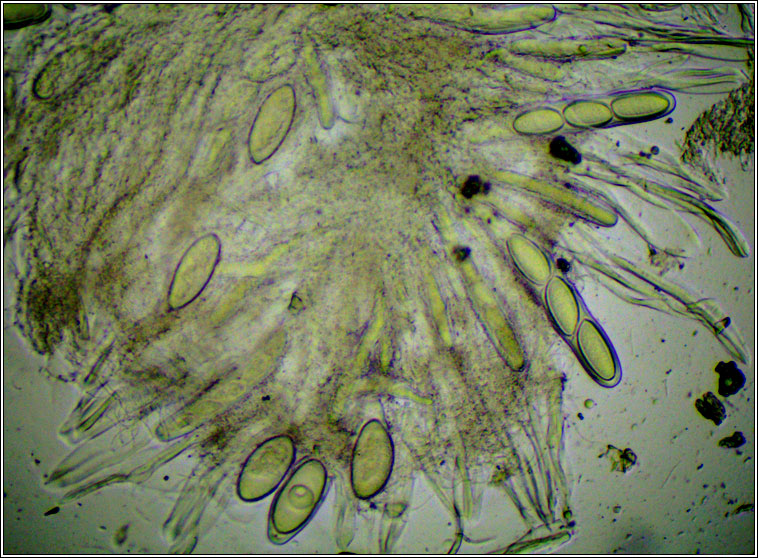 Pertusaria leioplaca, ascus