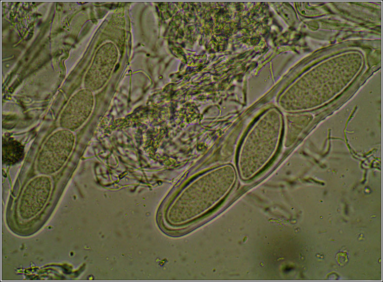 Pertusaria leioplaca, ascospore