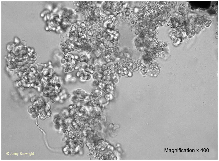 Illosporiopsis christiansenii, microscopy x 400