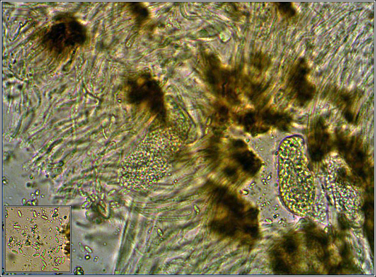 Sarcogyne regularis, ascus