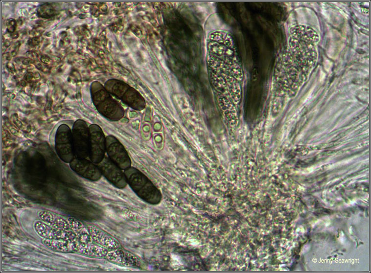 Physcia aipolia, microscope image