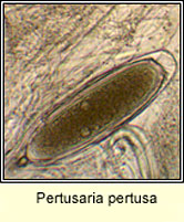 Pertusaria pertusa, ascospore