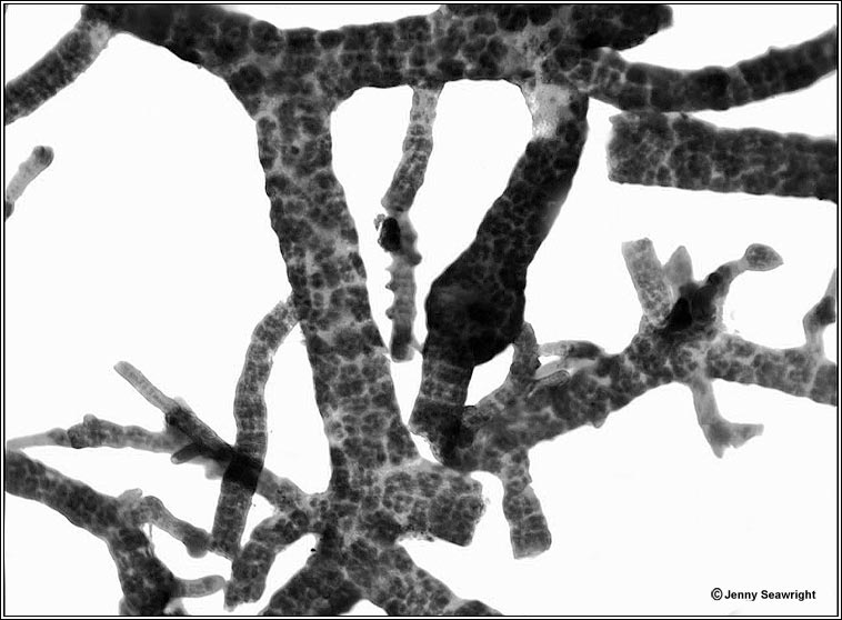 Ephebe lanata, microscope photo