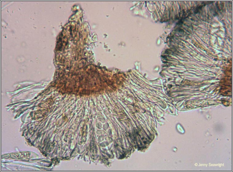 Lecidella elaeochroma, microscope image