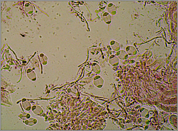 Caloplaca ferruginea, microscope photo