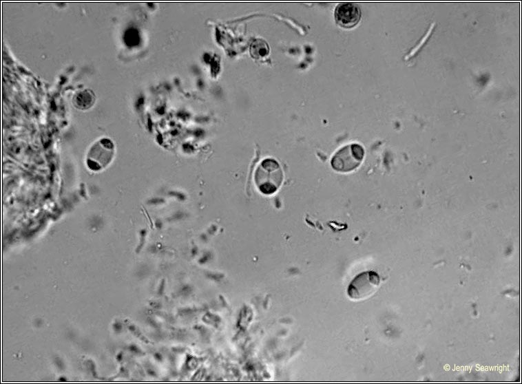 Caloplaca ferruginea, microscope photo