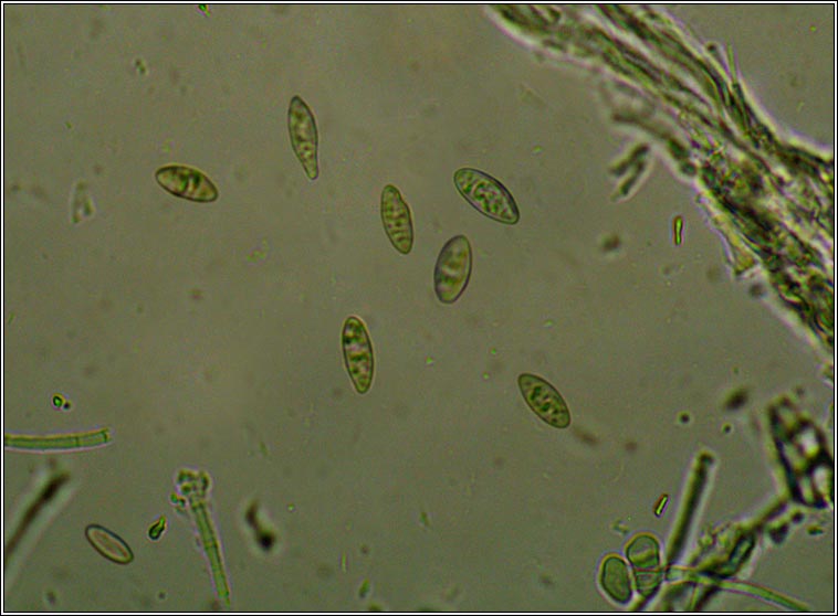 Degelia plumbea, microscope photo