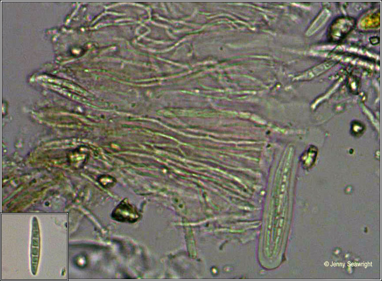 Enterographa crassa, microscope photo