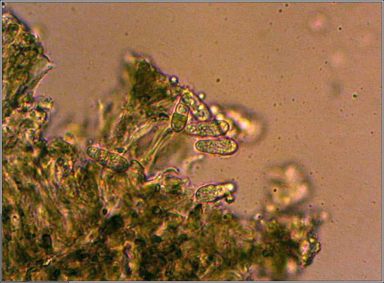 Arthonia radiata, microscope photo
