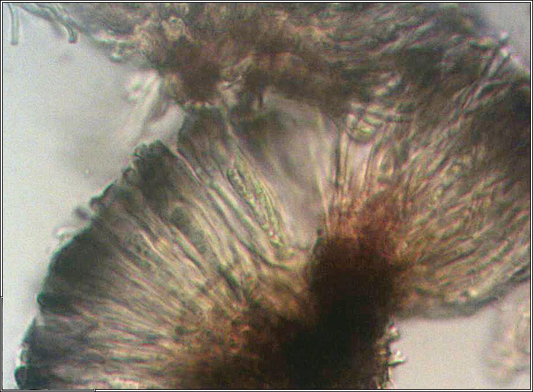 Toninia sedifolia, microscope photo