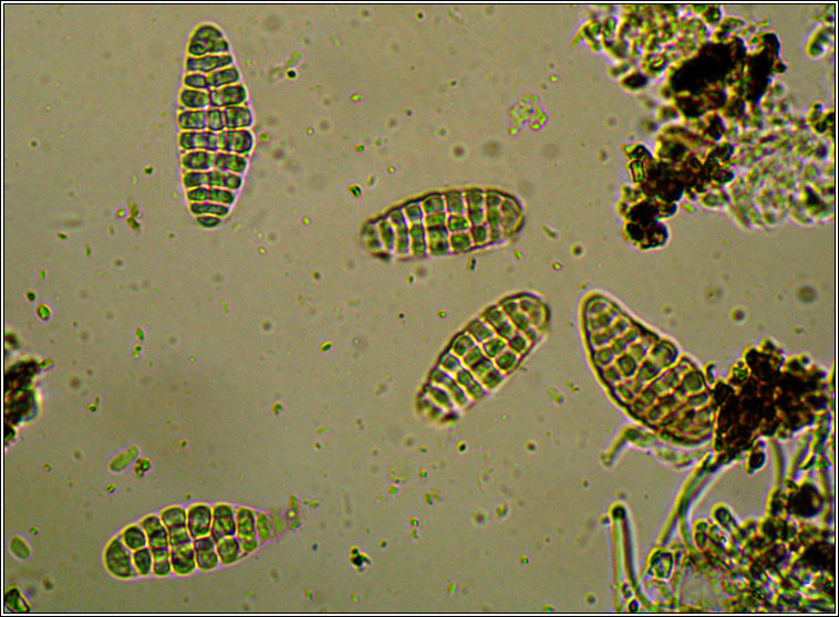 Graphina anguina, microscope photo