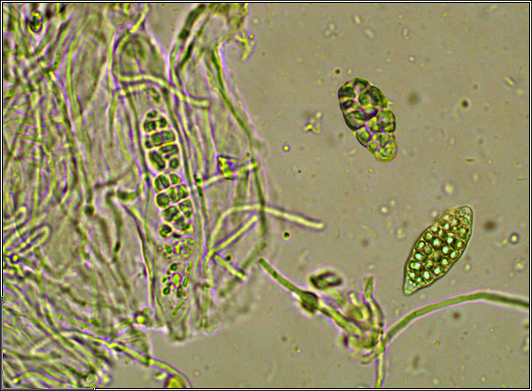 Leptogium pulvinatum, microscope image