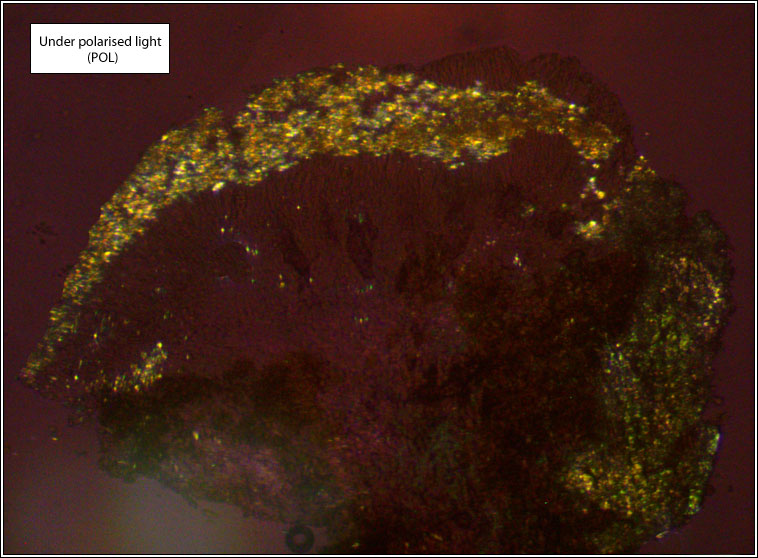 Lecanora carpinea, under polarised light (POL)