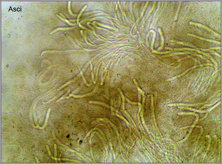 Gomphillus calycioides, microscope photo