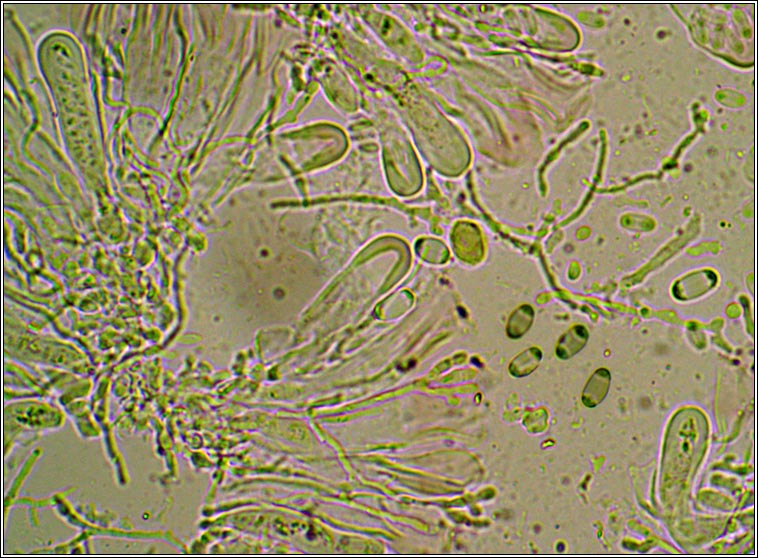 Caloplaca cerinella, ascospore