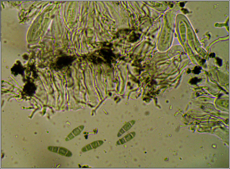 Opegrapha herbarum, microscope photos