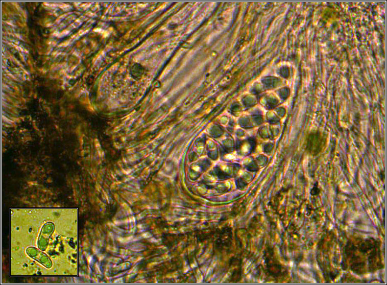 Candelariella vitellina, ascus and spores